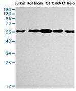 AKT1/AKT2/AKT3 Recombinant Rabbit Monoclonal Antibody