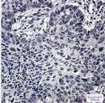 SRSF3 Recombinant Rabbit Monoclonal Antibody