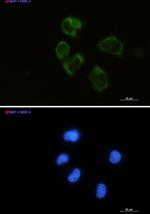 LYZ Recombinant Rabbit Monoclonal Antibody