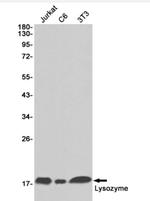 LYZ Antibody in Western Blot (WB)