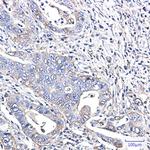 YBX1 Antibody in Immunohistochemistry (Paraffin) (IHC (P))