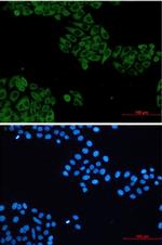 VAV2 Recombinant Rabbit Monoclonal Antibody
