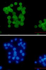 UBB Recombinant Rabbit Monoclonal Antibody