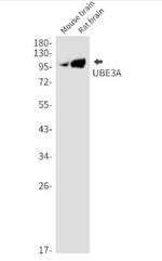 UBE3A Antibody in Western Blot (WB)