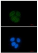 UBE2C Recombinant Rabbit Monoclonal Antibody