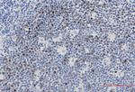 UBE2C Antibody in Immunohistochemistry (Paraffin) (IHC (P))