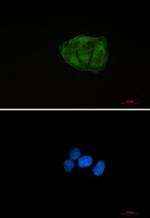 UBA52 Recombinant Rabbit Monoclonal Antibody