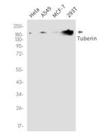 TSC2 Antibody in Western Blot (WB)