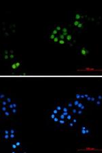 TPX2 Recombinant Rabbit Monoclonal Antibody
