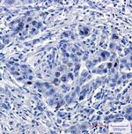 TPX2 Antibody in Immunohistochemistry (Paraffin) (IHC (P))
