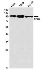 TPX2 Antibody in Western Blot (WB)