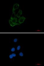 TFEB Antibody in Immunocytochemistry (ICC/IF)