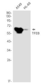 TFEB Antibody in Western Blot (WB)