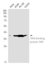 TBP Antibody in Western Blot (WB)