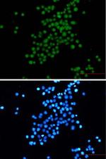 SV40gp6 Recombinant Rabbit Monoclonal Antibody