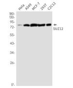 SUZ12 Recombinant Rabbit Monoclonal Antibody