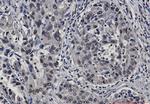 STAT4 Recombinant Rabbit Monoclonal Antibody