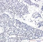 SUPT5H Antibody in Immunohistochemistry (Paraffin) (IHC (P))