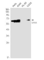 STK39 Antibody in Western Blot (WB)