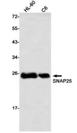 SNAP25 Antibody in Western Blot (WB)