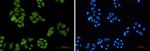 SMAD4 Antibody in Immunocytochemistry (ICC/IF)