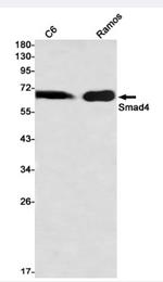 SMAD4 Antibody in Western Blot (WB)