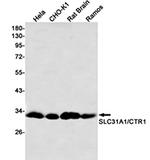 SLC31A1 Recombinant Rabbit Monoclonal Antibody