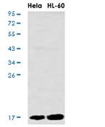 UBE2D1 Antibody in Western Blot (WB)