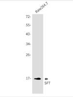 UBE2D1 Antibody in Western Blot (WB)