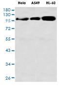 DLG1 Recombinant Rabbit Monoclonal Antibody