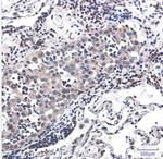 RPS6KA3 Recombinant Rabbit Monoclonal Antibody