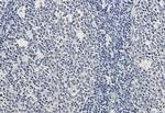 RAD51 Antibody in Immunohistochemistry (Paraffin) (IHC (P))