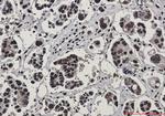 RAD50 Antibody in Immunohistochemistry (Paraffin) (IHC (P))