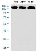 RAD50 Antibody in Western Blot (WB)