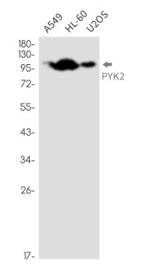 PTK2B Antibody in Western Blot (WB)
