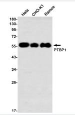 PTBP1 Recombinant Rabbit Monoclonal Antibody