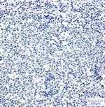 DLG2 Recombinant Rabbit Monoclonal Antibody