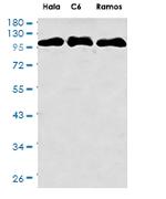 DLG2 Antibody in Western Blot (WB)