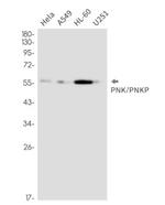 PNKP Recombinant Rabbit Monoclonal Antibody