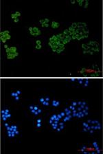 PLCG1 Recombinant Rabbit Monoclonal Antibody