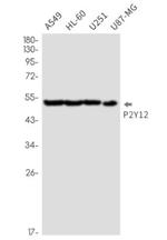 P2RY12 Antibody in Western Blot (WB)