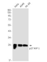 Cdkn1B Antibody in Western Blot (WB)