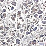 OPTN Recombinant Rabbit Monoclonal Antibody