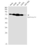 OPTN Antibody in Western Blot (WB)
