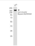 MYH10 Antibody in Western Blot (WB)