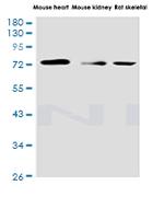 NDUFS1 Antibody in Western Blot (WB)