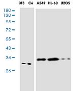 MTAP Recombinant Rabbit Monoclonal Antibody
