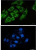 MSN Recombinant Rabbit Monoclonal Antibody