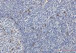 MERTK Recombinant Rabbit Monoclonal Antibody