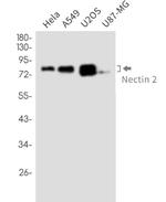 LMAN1 Antibody in Western Blot (WB)
